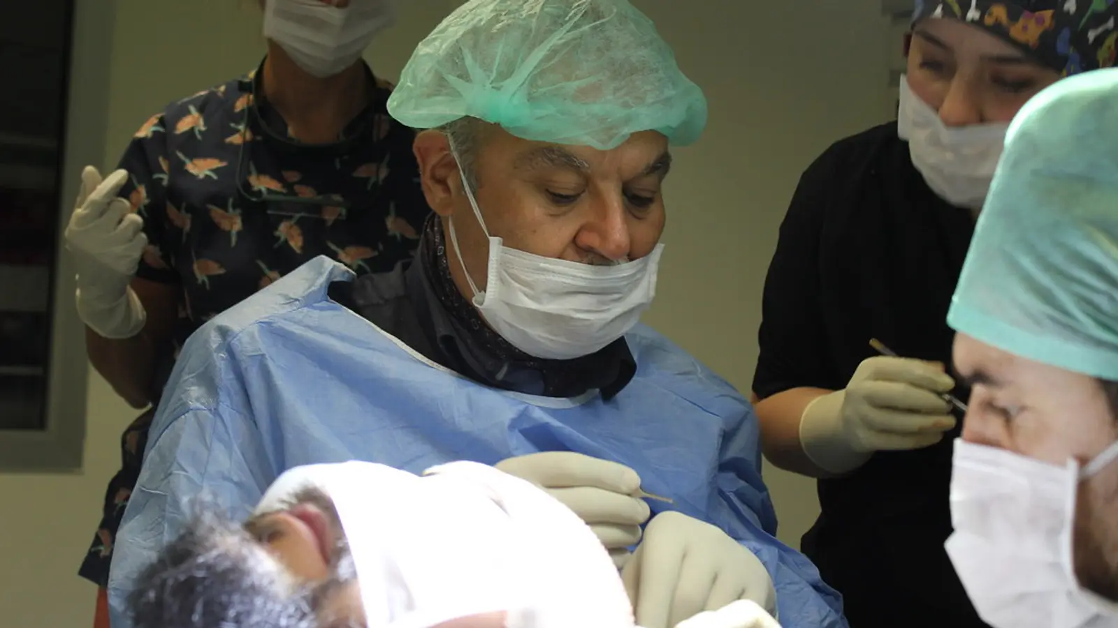 רופא וצוות מבצעים השתלת שיער בחדר הטיפולים, מטופל שכוב לפניהם
