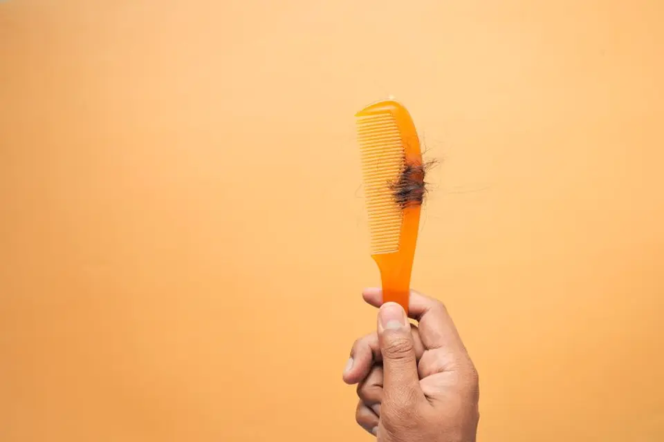 יד מחזיקה מסרק עם שערות שנשרו